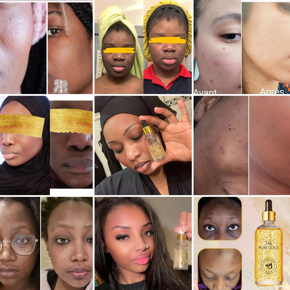Crème De Nuit « Peau Jaune » – Éclaircit, Corrige Les Taches & Lisse – 300 Ml – FPS 0 – Neuf