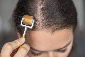 Est-ce que le passage du dermaroller sur le cuir chevelu est douloureux ?