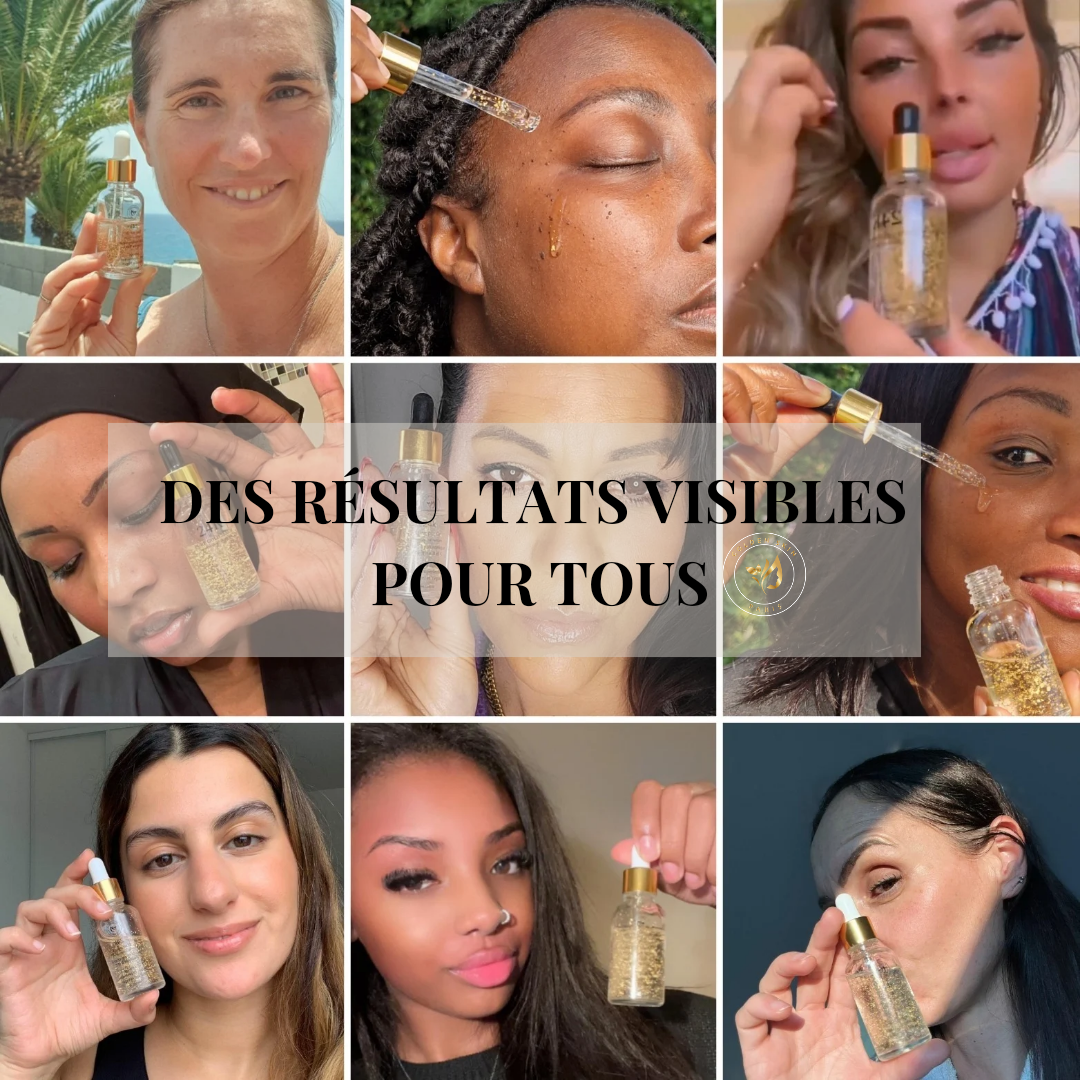 meilleur serum vitamine c
meilleur serum anti tache
sérum anti tache
sérum vitamine c visage
sérum vitamine c meilleur
cosmétique peau noire
comment avoir un beau teint
avoir un beau teint
hyperpigmentation peau noire
tâche hyperpigmentation
melasma
melasma melasma
hyperpigmentation visage
tâche brune
enlever les tâches brunes sur le visage
serum anti-imperfection
serum tâches brune visage
melasma melasma
enlever les tâches brunes sur le visage
serum anti tache peau noire
anti taches brunes
serum anti tache