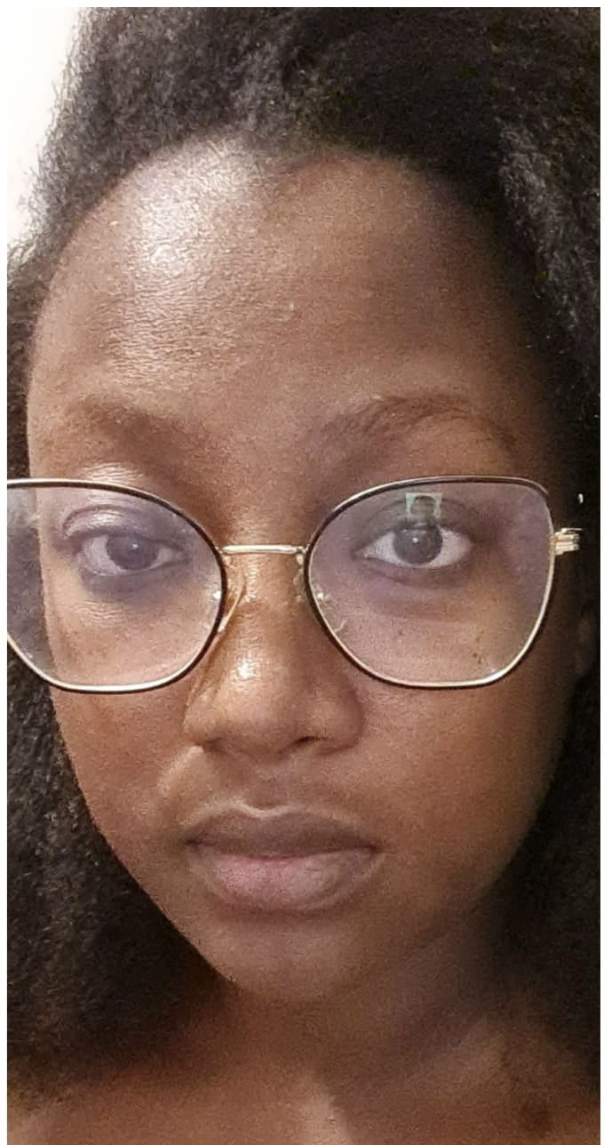 cosmetique peau noire
beau teint
hyperpigmentation
hyperpigmentation peau noire
tâche hyperpigmentation
hyperpigmentation visage
skincare
serum anti tache
serum anti imperfection
serum anti age
serum vitamine C