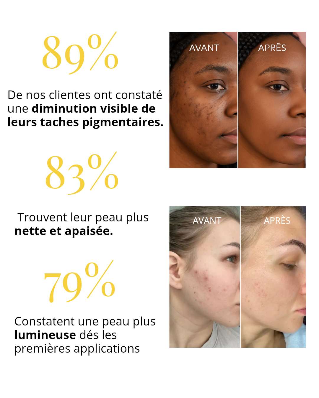 Sérum Pur Gold- Anti-Taches, Anti-Rides & Eclat immédiat